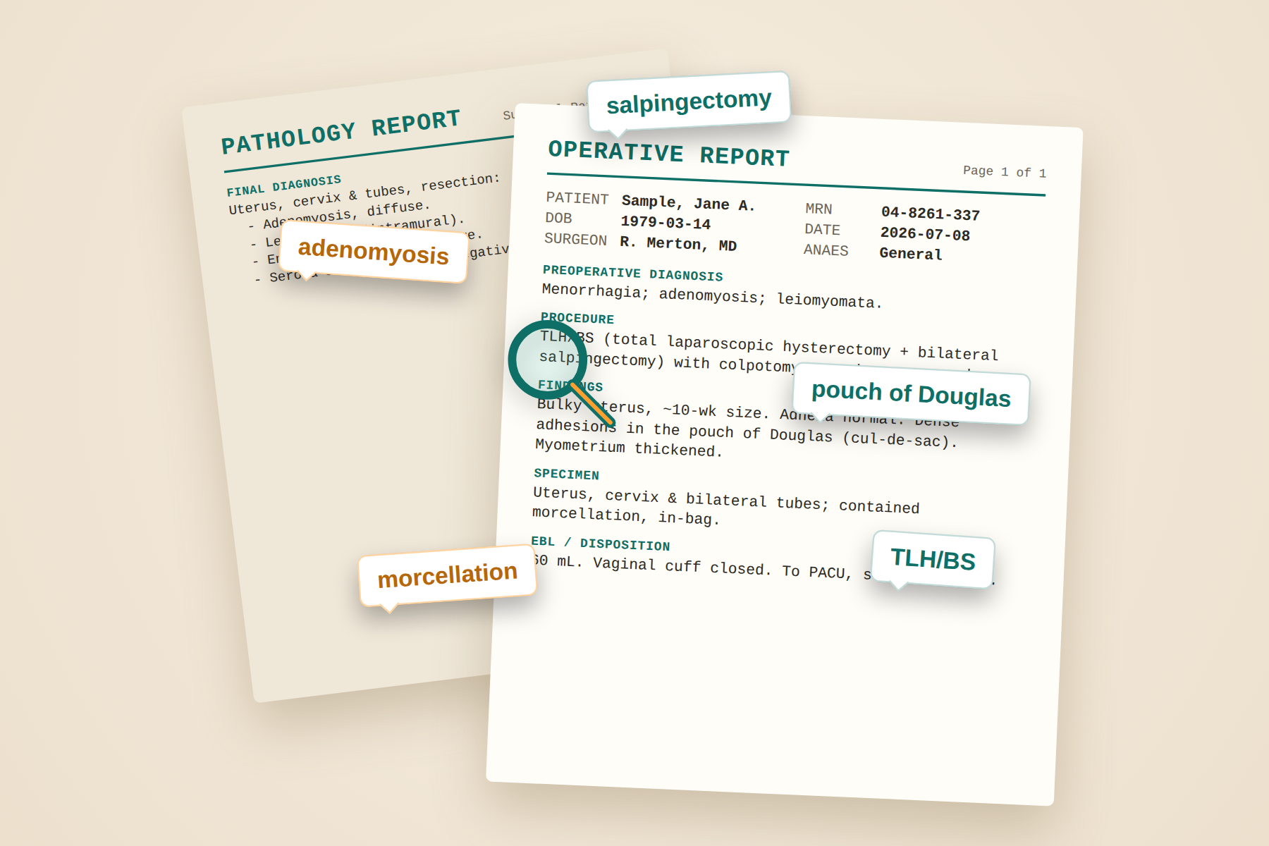 Hysterectomy Operative Report